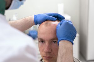 When Will Hair Transplant Results Become Visible?